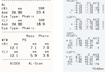 図１）装用前トポグラフィデータ・レフケラデータ・角膜径データ